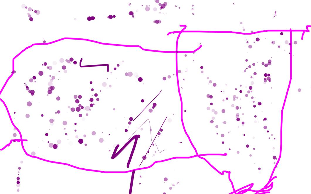 Tpn