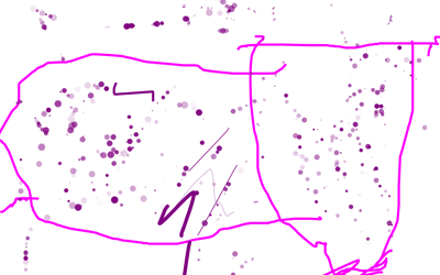 Tpn